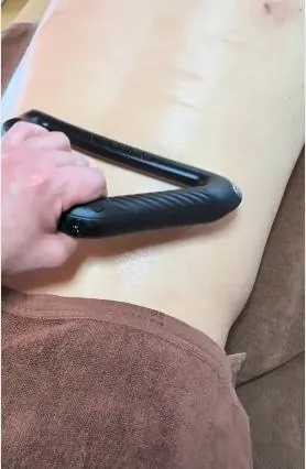 電動かっさ施術